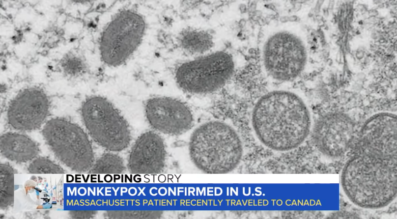 First COVID-19, Now Monkeypox…
