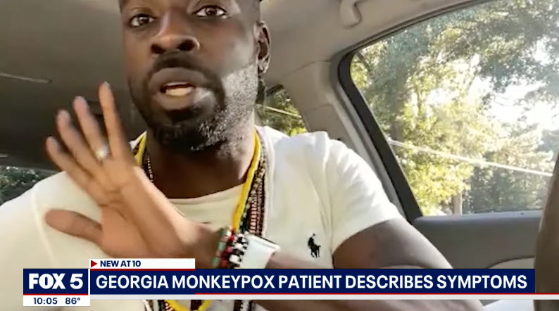 Georgia Man Says He Did Not Contract Monkeypox By Having Sex