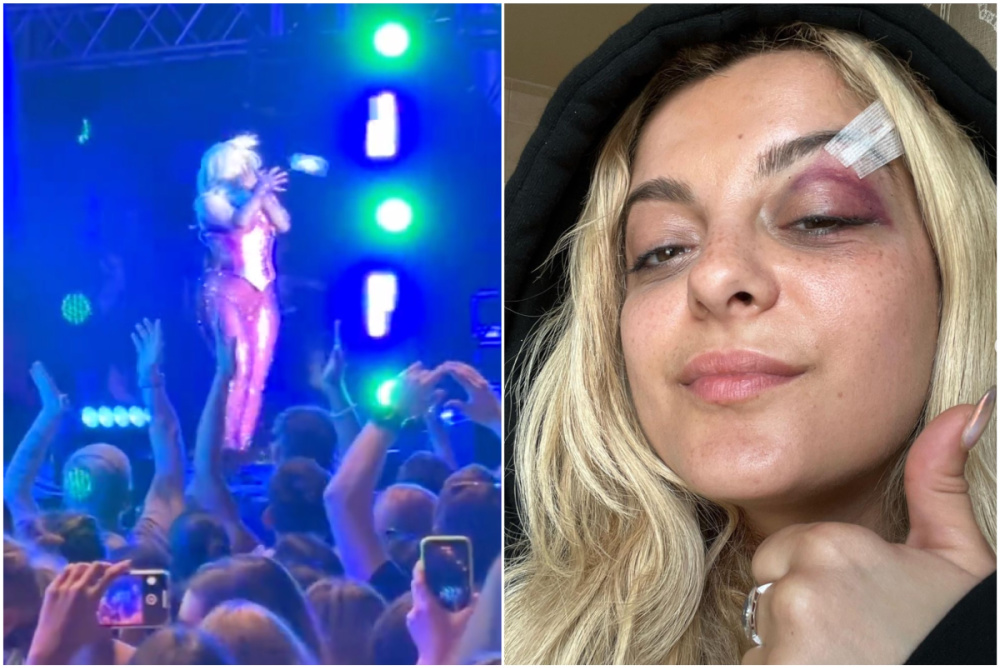 Bebe Rexha hit in face with cell phone