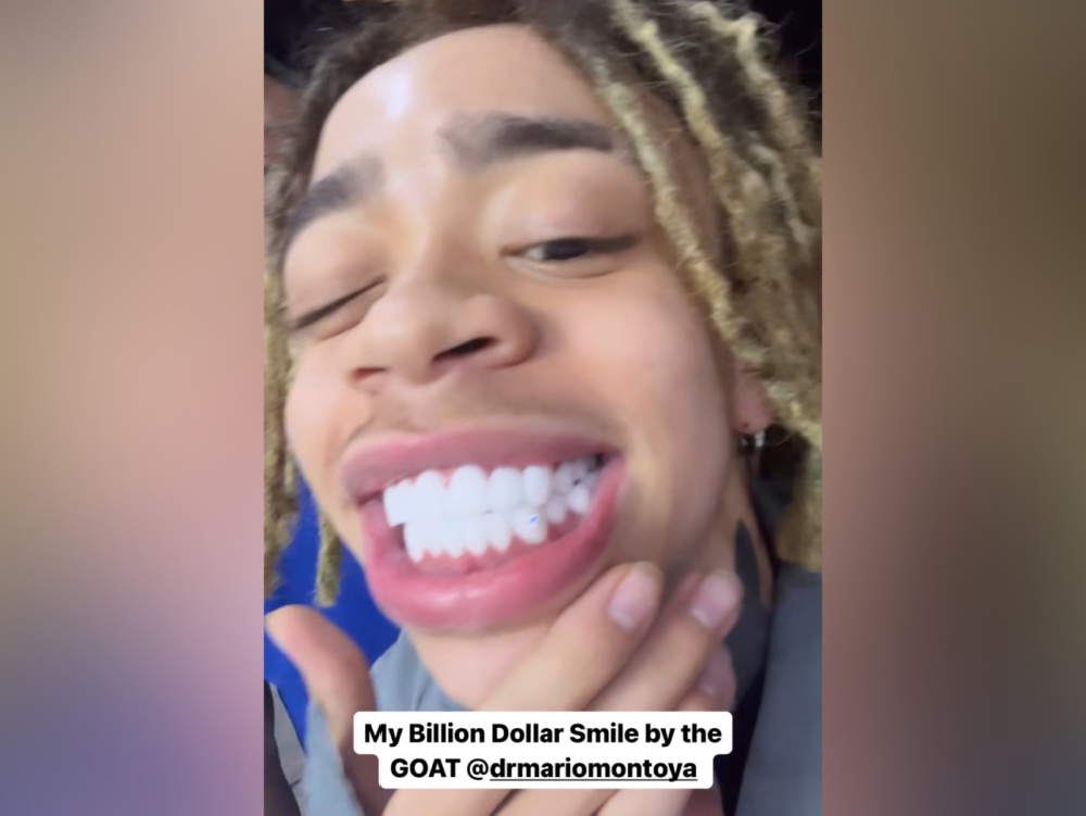 king-harris-billion-dollar-smile