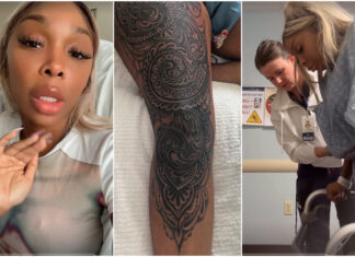 sierra-gates-hospitalized-massive-leg-tattoo