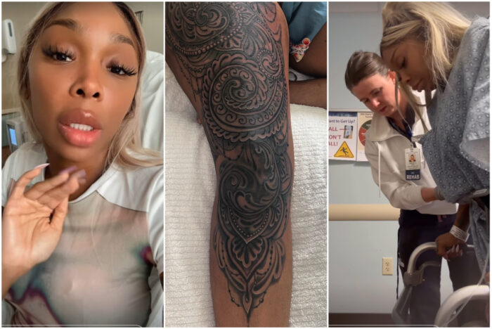 Sierra Gates Hospitalized, ‘Learning To Walk’ After Massive Leg Tattoo