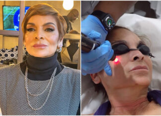 Jasmine Guy Shares Her Journey Of Anti-Aging Pico Laser Treatments jasmine-guy-pico-laser-anti-aging-treatment