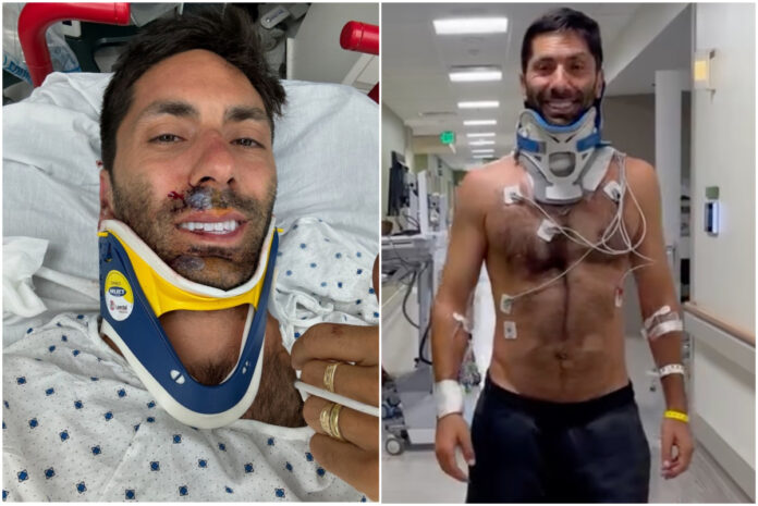 nev-schulman-broken-neck-bike-accident