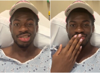 Lil Nas X Says He Lost Control Of The Right Side Of His Face Lil-Nas-X-Bells-Palsy