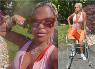 Misa Hylton Speaks On Her Injury, Court Appearance & Shares Message For Disabled Community Misa Hylton speaks on her injury, court appearance, and message to disabled people