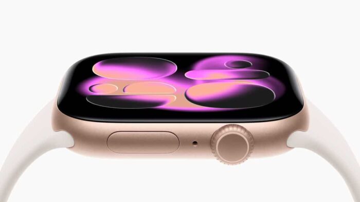 Apple Watch Series 11 with advanced health features, longer battery life, and a display that is twice as scratch resistant.