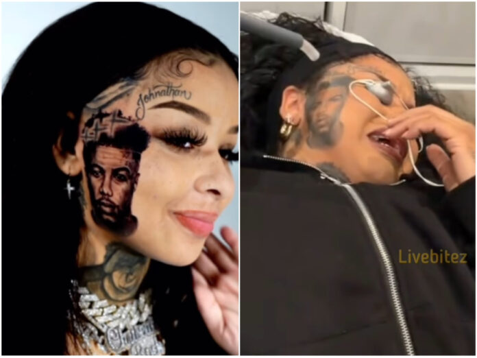 Chrisean Rock shared an emotional video removing her Blueface face tattoo, breaking down in tears as Blueface flaunted a new girlfriend’s tattoo.
